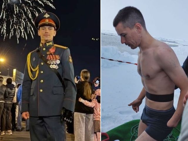 Герою СВО трижды кавалеру ордена Мужества пересадили донорскую руку