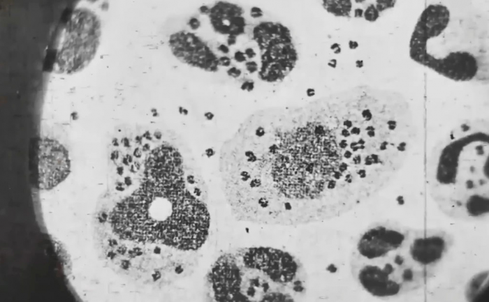 Чёрная оспа: Как русский художник чуть не погубил половину Москвы