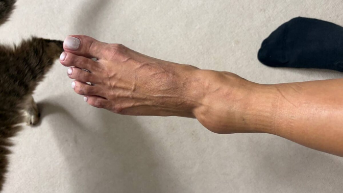 Виктория Боня попала в беду. Планы сорваны. В Сети – шокирующие кадры